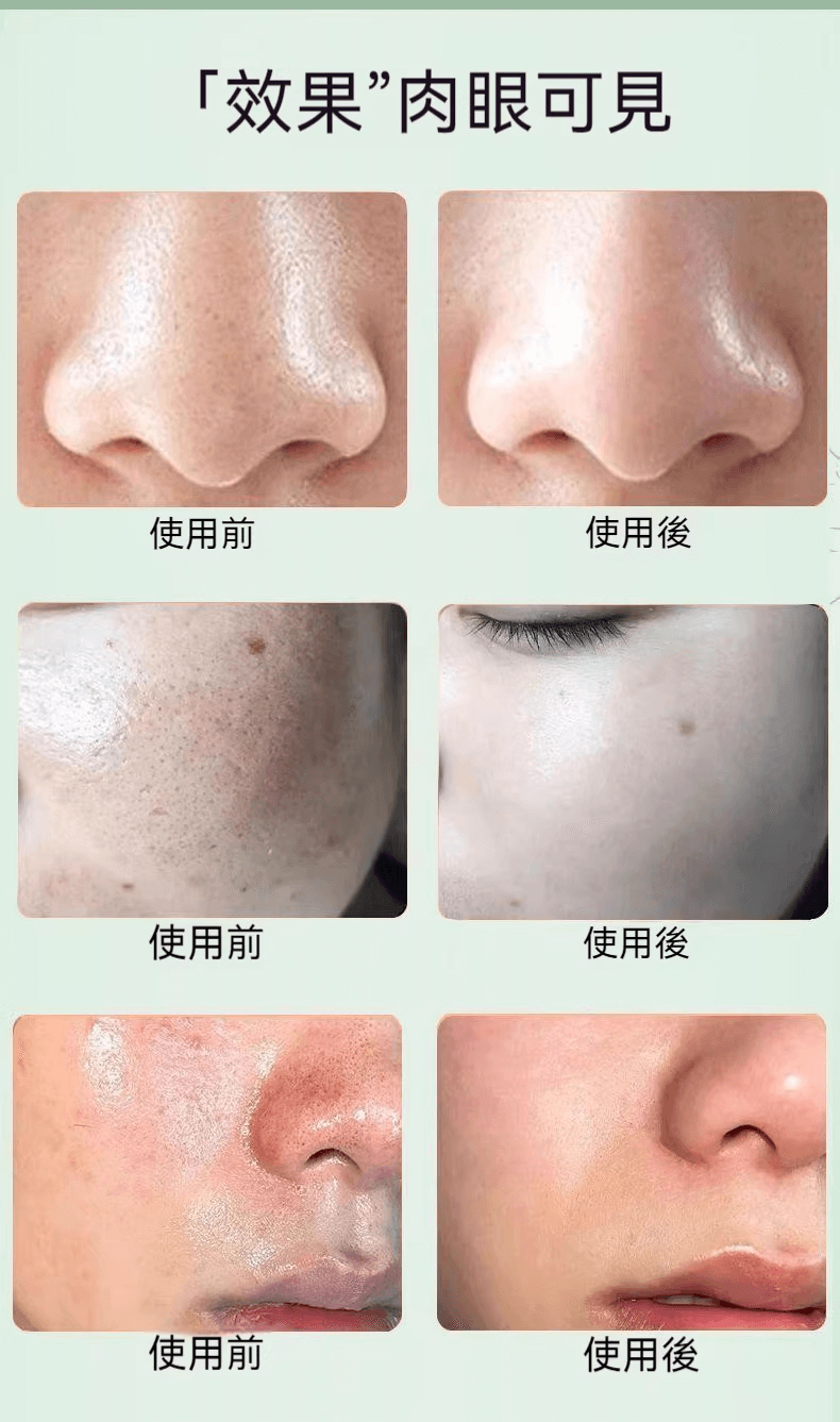 積雪草泡泡面膜